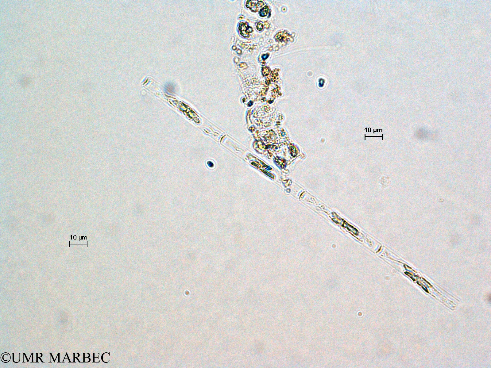 phyto/Scattered_Islands/all/COMMA April 2011/Leptocylindrus danicus (ancien L. sp1 cf danicus -3)(copy).jpg